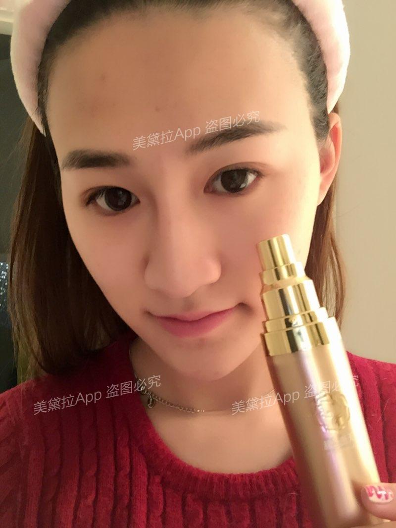 想永久脱发际线和唇毛的先看这里!
